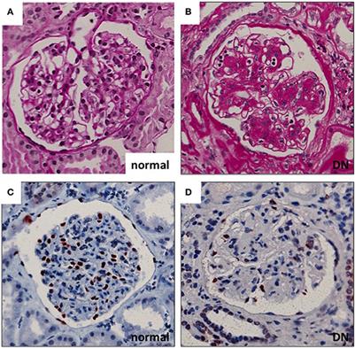 Understanding Podocyte Biology to Develop Novel Kidney Therapeutics